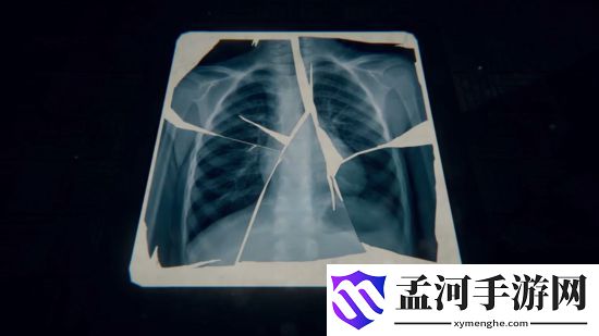 还愿杜美心到底得了什么病？